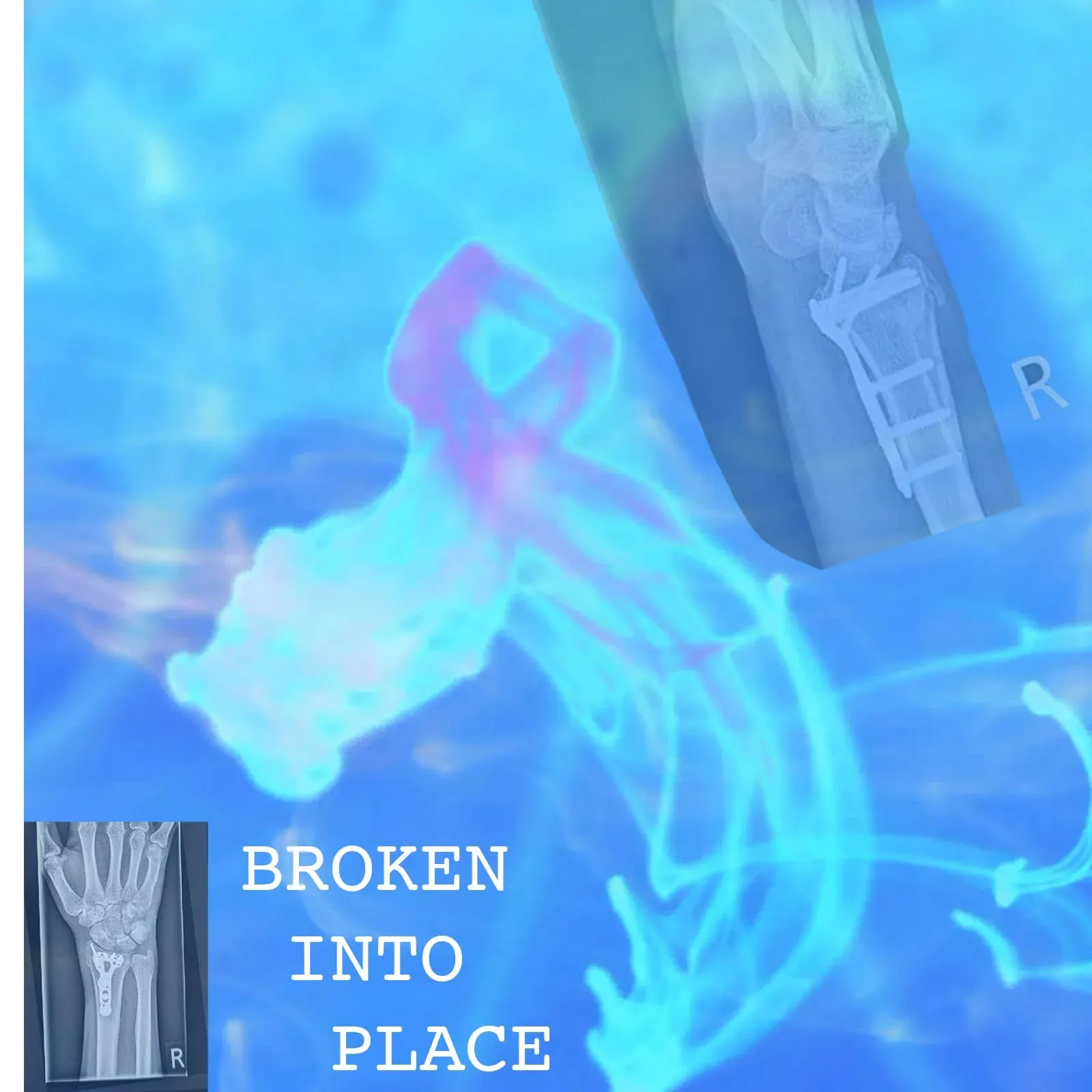 Broken Into Place
